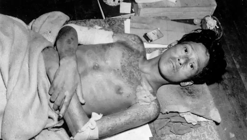 80 Yıl Sonra Nagasaki’den Nükleer Felaket Uyarısı: Zaman Tükeniyor!