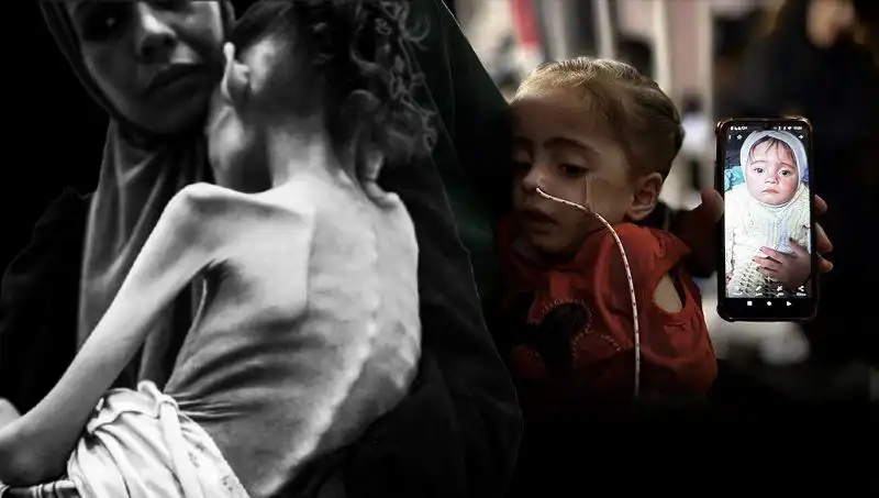 Küçük Meryem’in Dramı: 25 Kilodan 10 Kiloya Düştü, Açlıkla Savaş Veriyor