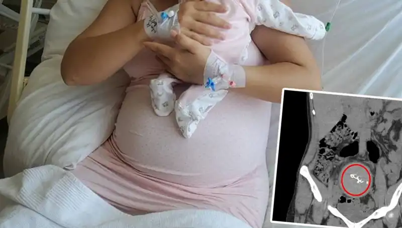 Doğumda Gazlı Bez Unutuldu, İki Yıl Sonra Facia Ortaya Çıktı!